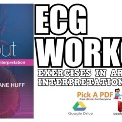 Ecg workout exercises in arrhythmia interpretation answer key