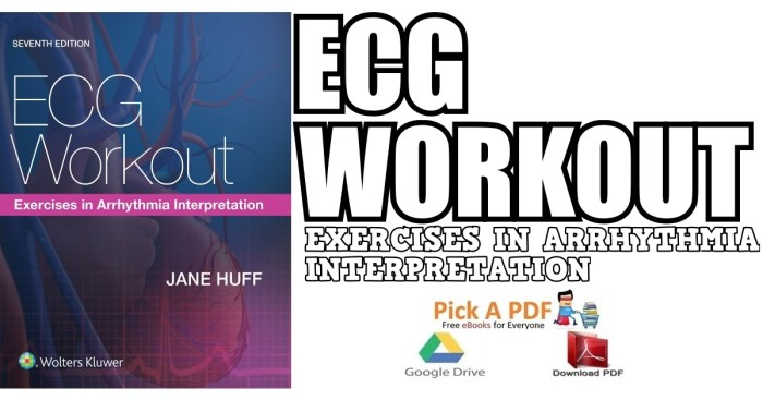 Ecg workout exercises in arrhythmia interpretation answer key