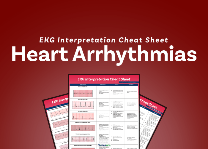 Ecg workout exercises in arrhythmia interpretation answer key